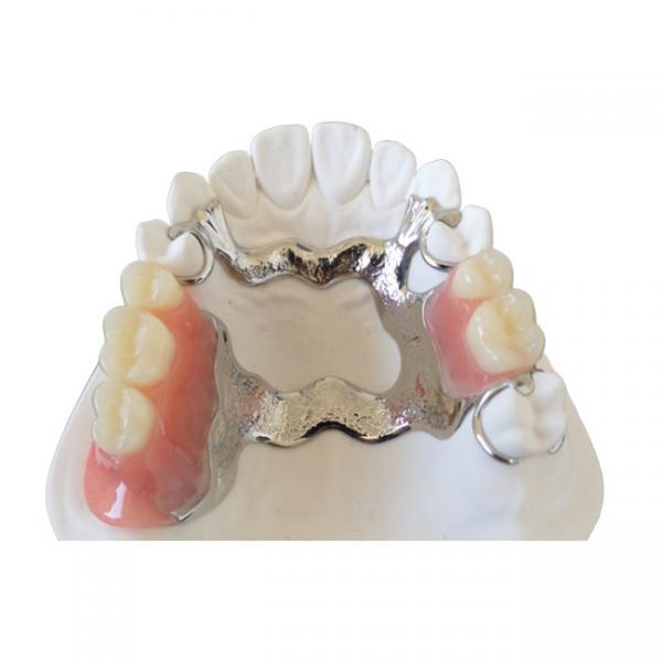 Quality OEM 3D Printer PFM Dental Crowns Bridge High Biological Intermiscibility for sale