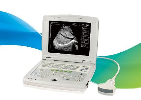 Ultrasound Scan Machine Portable Ultrasound Scanner with 10.4 Inch LED Monitor