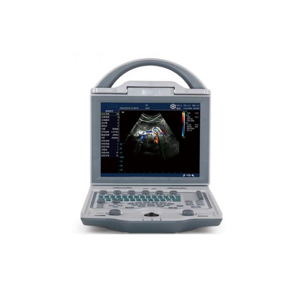 Quality Portable Echocardiography Machine Portable Ultrasound Scanner With 10.4 Inch Adjustable Monitor for sale