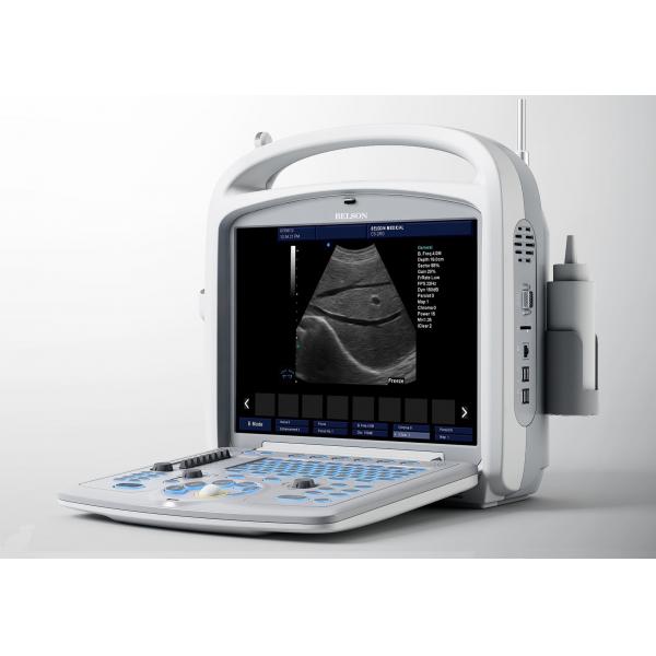 Quality Medical Ultrasound Machine Portable Ultrasound Scanner 4d Ultrasound Equipment for sale