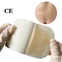 China CE EN13485 ISO Surgical Transparent Wound Dressing Waterproof factory