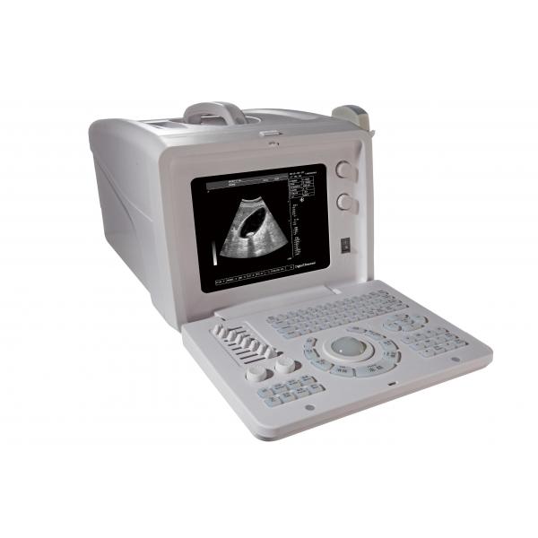 Quality Portable Sonogram Machine Portable Ultrasound Scanner with Multi-frequency for sale