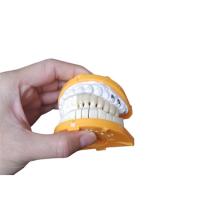 Quality Custom Size PFM Ceramic Crowns For Posterior And Anterior Teeth for sale