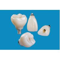 Quality Professional Zirconia Dental Implant Crown Titanium CAD CAM for sale