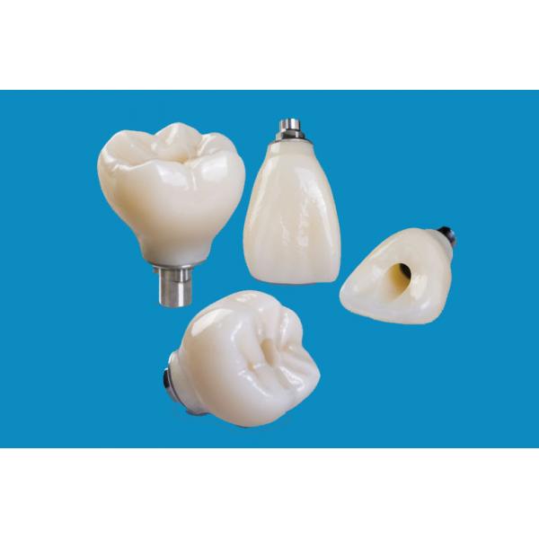 Quality Professional Zirconia Dental Implant Crown Titanium CAD CAM for sale