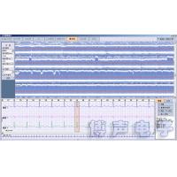 China BORSAM PC Based EKG Analyzer Holter ECG Software System factory
