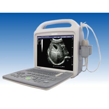 Quality 12 " LCD Screen Portable Ultrasound Device Digital High Resolution With B, B+B, for sale