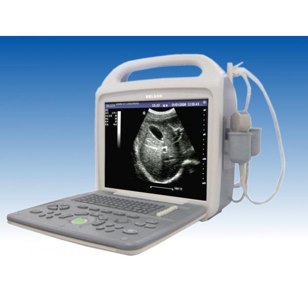 Quality 12 " LCD Screen Portable Ultrasound Device Digital High Resolution With B, B+B, for sale