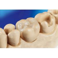 China Porcelain Dental Inlay Onlay Zirconia Emax High Esthetics FDA Approved factory