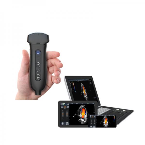 Quality Medical Handheld Ultrasound Doppler Scan Machine With Cardiac Transducer for sale