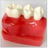 China Anatomical Patient Education Models Dental / Teeth Demonstration Model factory