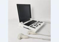 Buy cheap Handheld Bladder Scanner Portable Laptop Color Ultrasound System with 2 Probe from wholesalers