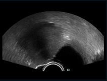 Quality Transvaginal Probe Mobile Color Doppler Ultrasound Scanner For Pregnancy for sale