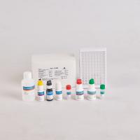 China Human PTH Elisa Kit/Human Parathyroid Hormone Elisa Kit for RUO with 96 Tests factory
