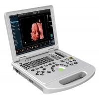 Quality CE 3D 4D 5D Portable Color Doppler Ultrasound Machine Scanner OEM for sale
