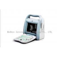 China High Accuracy Portable Ophthalmic A B Scan Ultrasound Machine factory