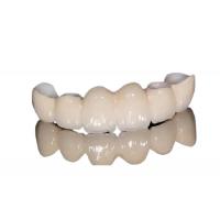 Quality Corrosion Resistant Porcelain Dental Crown Natural Appearance For Front Teeth / for sale