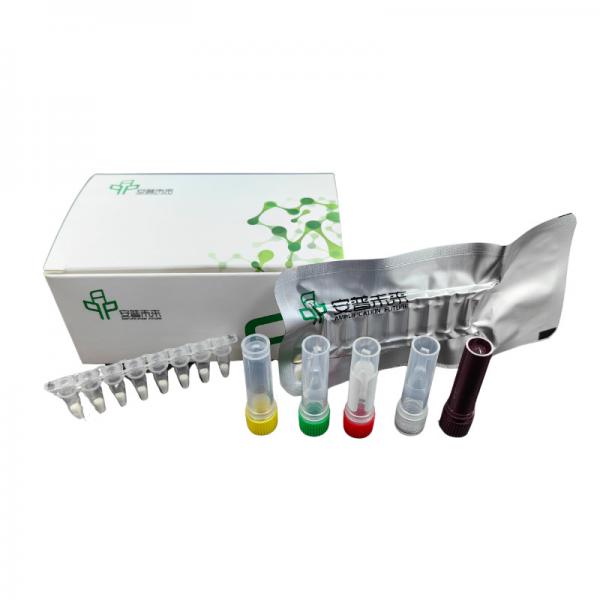Quality Efficient Enzymes SARS-CoV-2 Detection Kit Below 20 Degree For Reliable Results for sale