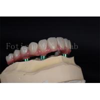 China Advanced Full Chewing Ability Restoration Implant Procedure for Low Bone Density Patients for sale