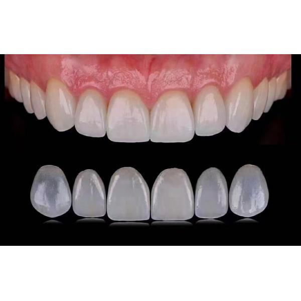 Quality Tranlucent Emax Laminate Veneers / Porcelain Dental Veneers ISO Approved for sale