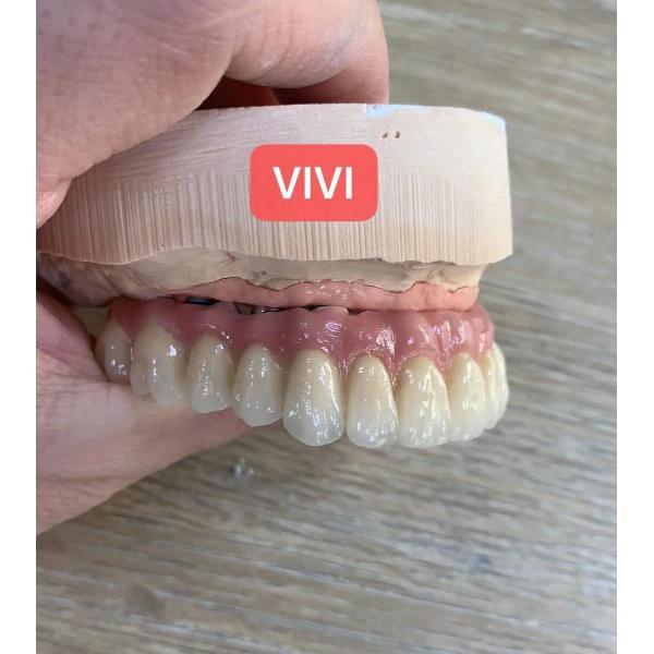 Quality ISO Esthetic Dental Implant Crown Precise Bridge Tooth Implant for sale