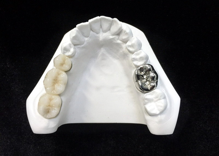 China Ultra Hard Digital Porcelain Dental Crown Health Safety High Density for sale