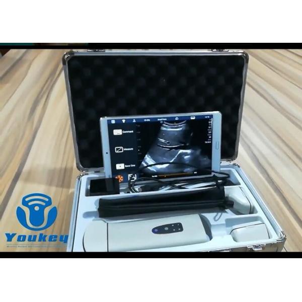 Quality Portable Color Doppler Machine Handheld Ultrasound Scanner With Frequency 2 for sale