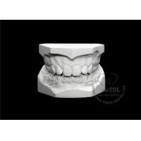 china White Orthodontic Diagnostic Records Plaster Gypsum Models