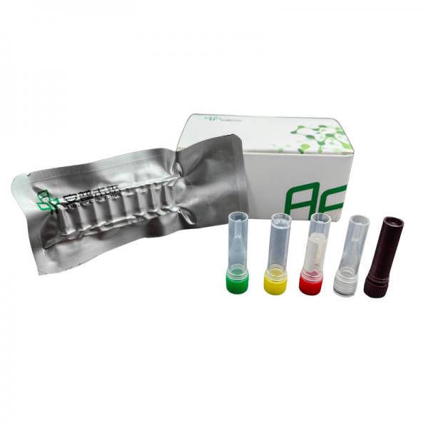 Quality 48 Tests/Box Buffers SARS-CoV-2 Detection Kit For Accurate Results for sale