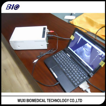 Quality Small Portable Ultrasound Machine Probes With 2~11MHz Frequency 160g Weight Only for sale