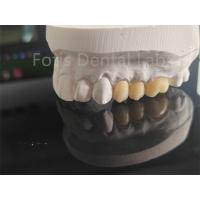 China High Strength  Full Porcelain Layered Zirconia For Dental Crowns factory