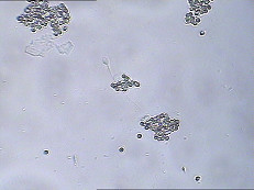 Quality MAR IgA Test Kit IgA Antibody Coating Spermatozoa MAR Sperm Function Test Kit for sale