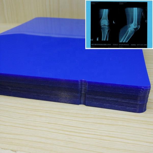 Quality ISO9001 Blue Inkjet Film Medical Inkjet Printing Film 11*14In for sale