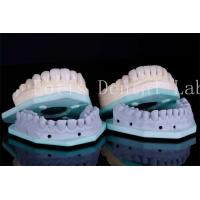 China Stain Resistant Dental Teeth Veneers Dental Clinic Veneers 0.3mm-0.5mm Thickness factory