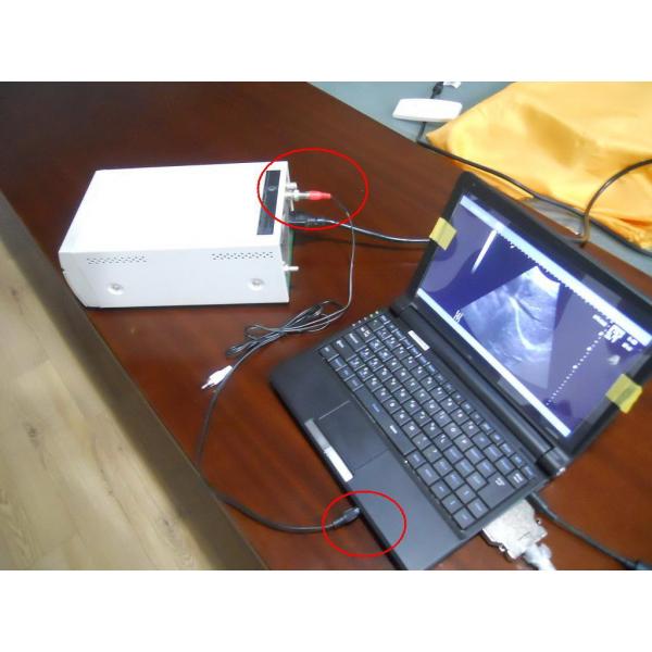 Quality Mobile Ultrasound Machine Digital Laptop Ultrasound Scanner with 100 Frames for sale