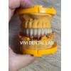 Quality Translucent Digital Dental Crowns Implant PFM With Pink Porcelain for sale