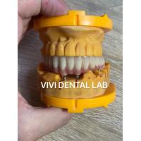 Quality Digital Dental Crowns for sale