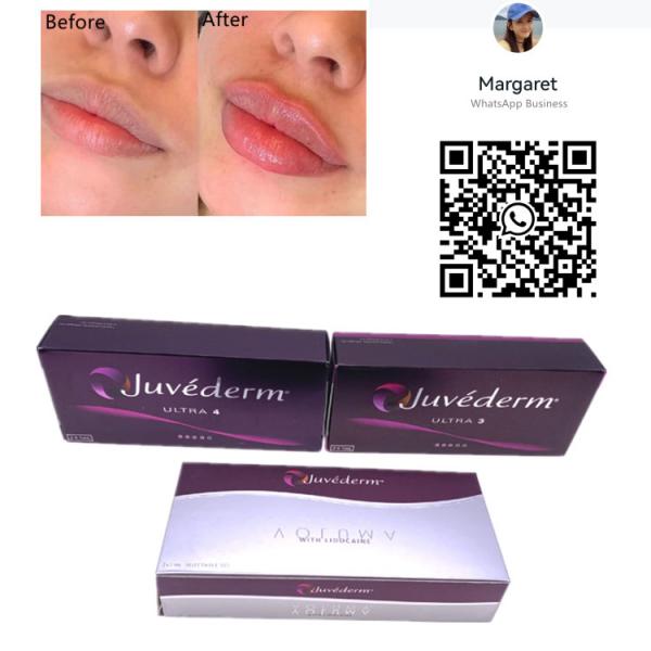 Quality Juvederm Dermal Filler 2x1ml Syringe Needles Cross Linked Gel Lip Injection for sale