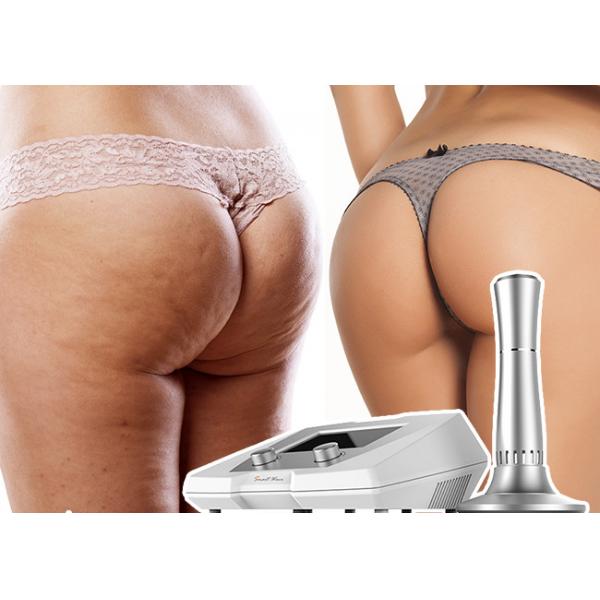 Quality Skin Tighten & Stretch Marks & Cellulite Treatment Acoustic Wave Therapy Equipment for sale