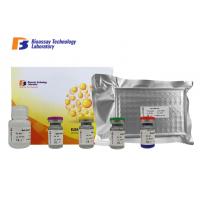 China High Specificity and Sensitivity Mouse Matrix Gla Protein ELISA Kit 96 Wells Customized for sale