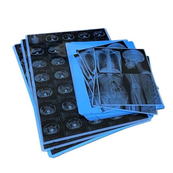 Quality 210um Waterproof Medical Dry Film Inkjet Printing Film 14x17 Inch for sale