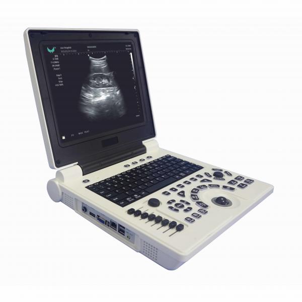Quality ISO Electron Scan Notebook USG Scan Machine For Obstetrics And Gynecology for sale
