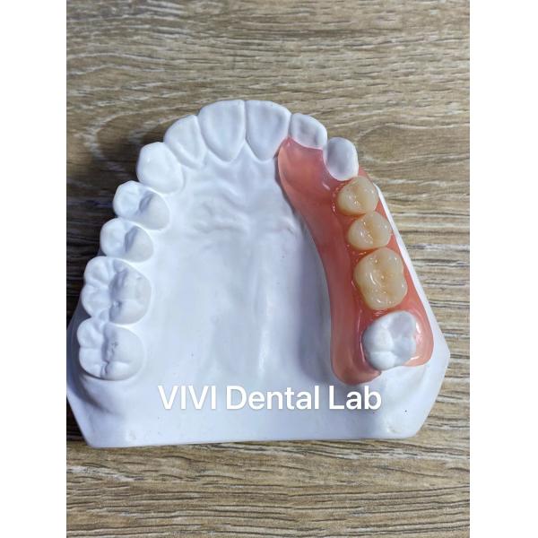 Quality High Esthetics Flexible Acrylic Partial Denture / Valplast Dental Partials for sale