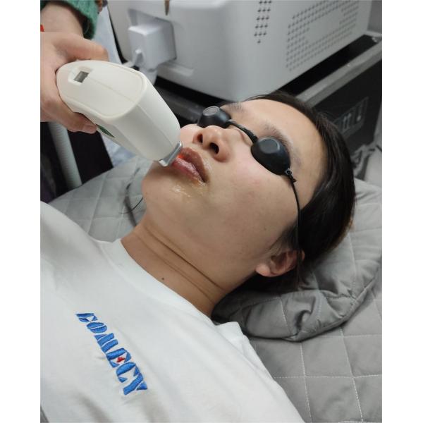 Quality IPL Portable Skin Hair Reduction Machine For Vascular Lesions And Facial Blemish for sale