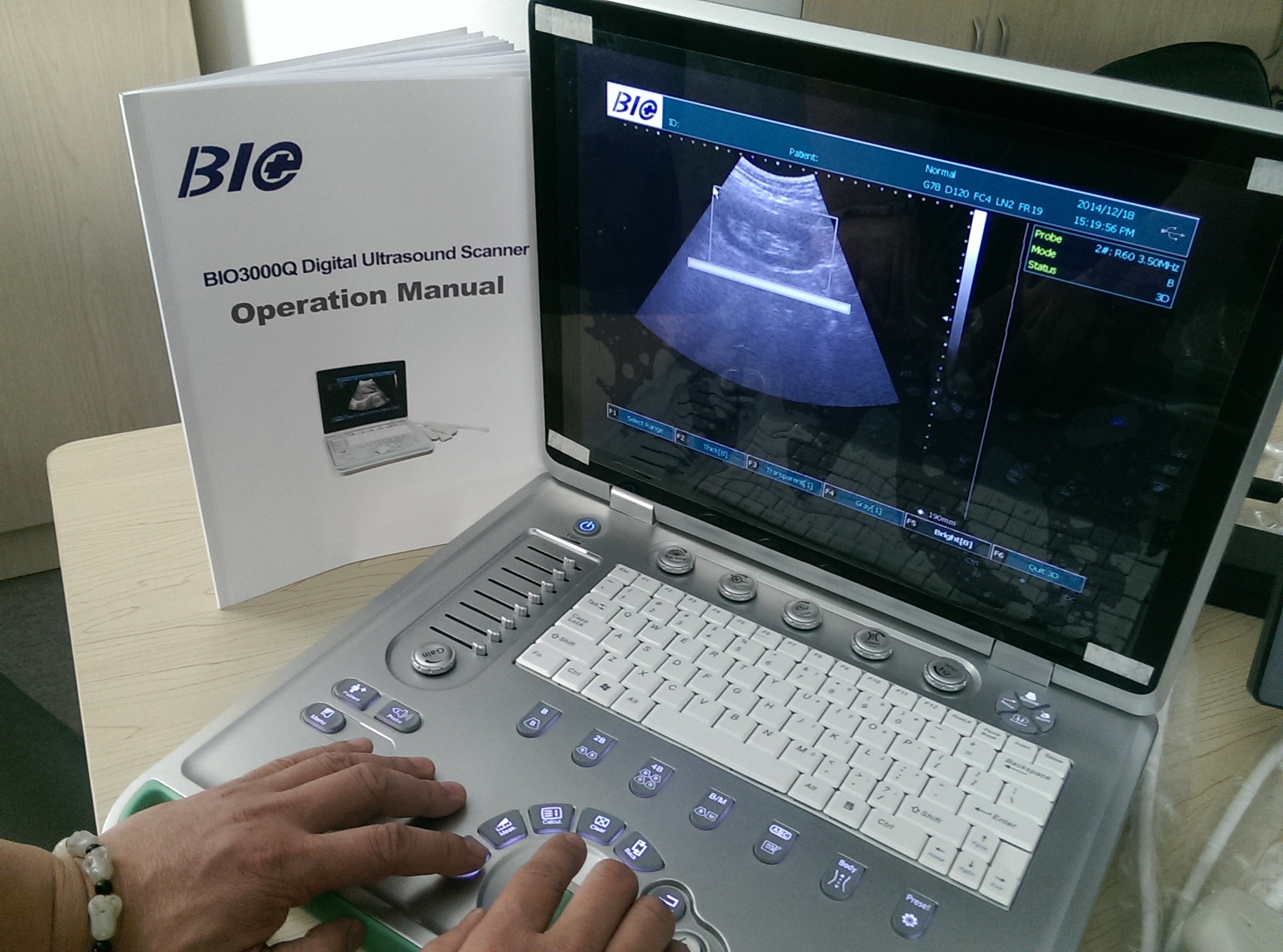 China PC Based B / W Portable Ultrasound Scanner 15 inch Laptop Screen Only 5kgs Weight Convenient to Carry factory