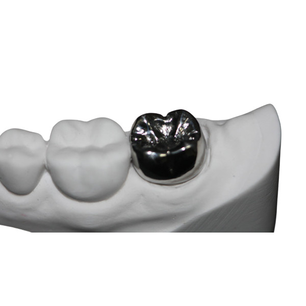 Quality Natural Colour Stability FDA Dental Crown Bridge Corrosion Resistant for sale
