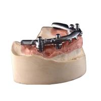 China High-Density PFM Dental Implants Dentures Strong Hardness Long Lasting​ factory