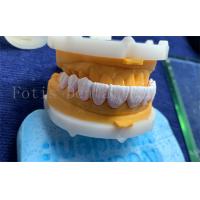 China Advanced Digital Dental Crowns Implant Dentrue Crown FDA/ISO/CE Certified factory