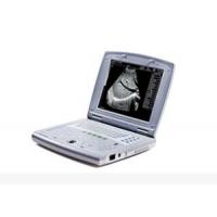 China Portable Baby Ultrasound Machine Portable Ultrasound Scanner for Pediatrics factory