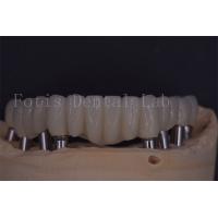China Reliable Dental Implant Crowns For Comfort And Functionality factory